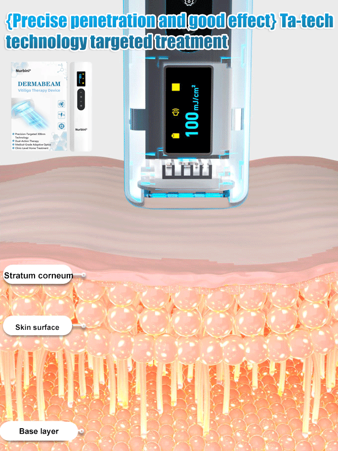 Simple At-Home Treatment⏳Limited-time 50% off⏰💥