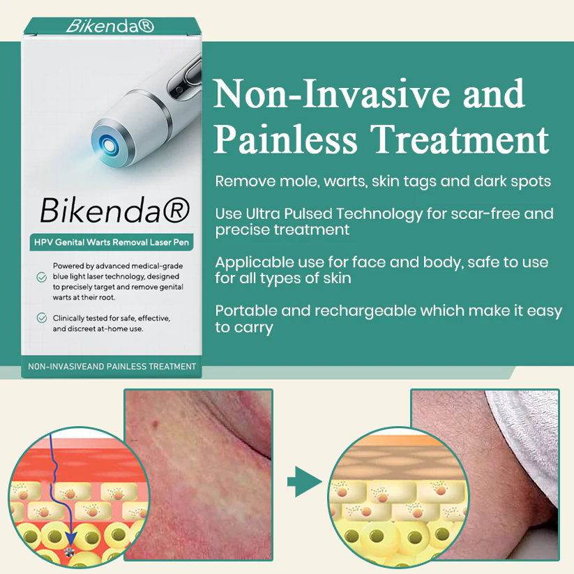 Bikenda® HPV Genital Warts Removal Laser Pen